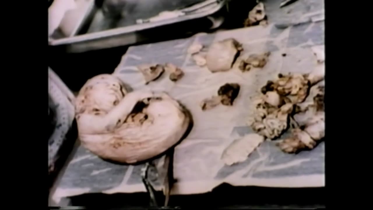 1982 - Storage Container Of Aborted Babies Found