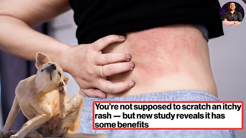Scratching That Itch Might Not Be as Bad On Bad Rashes As You Thought!