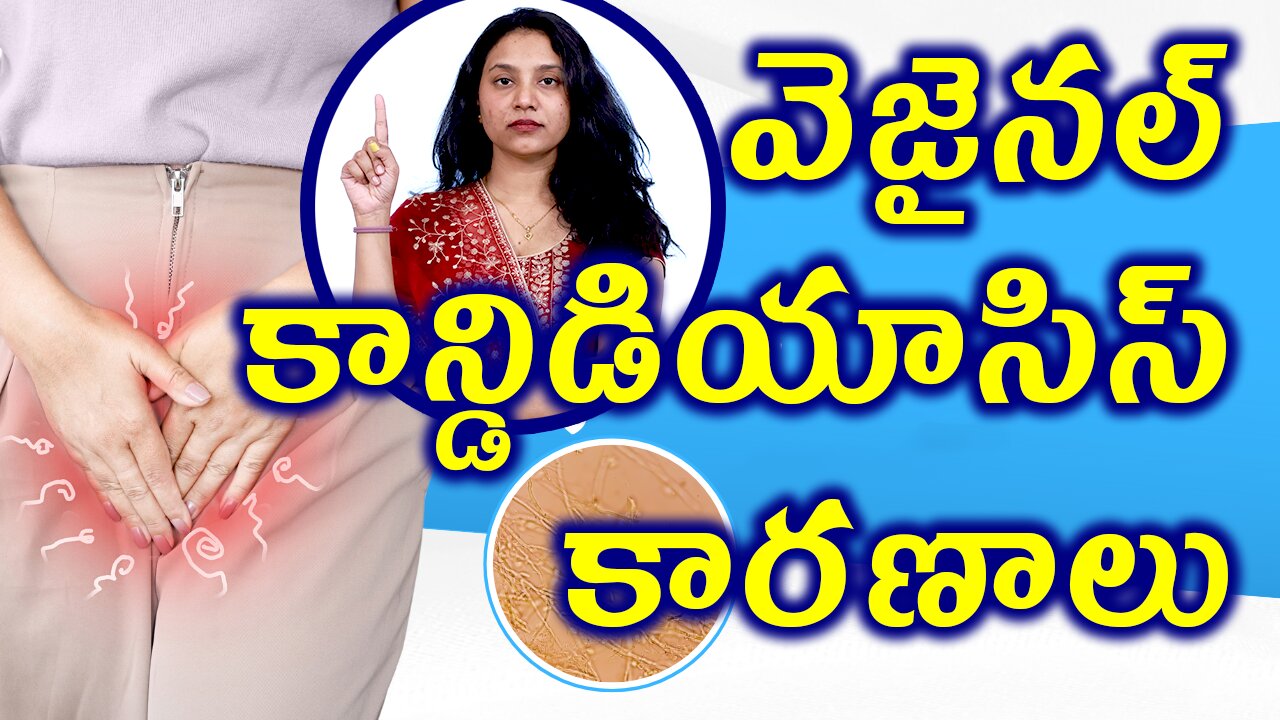 వెజైనల్ కాన్డిడియాసిస్ కారణాలు Causes of vaginal candidiasis