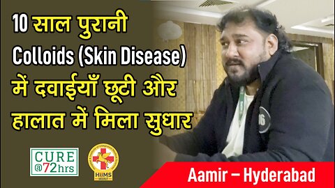 10 साल पुरानी Colloids (Skin Disease) में दवाईयाँ छूटी और हालात में मिला सुधार