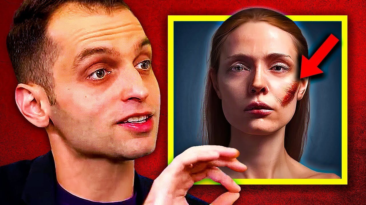 Explained: The Facial Scar Test (Social Experiment)