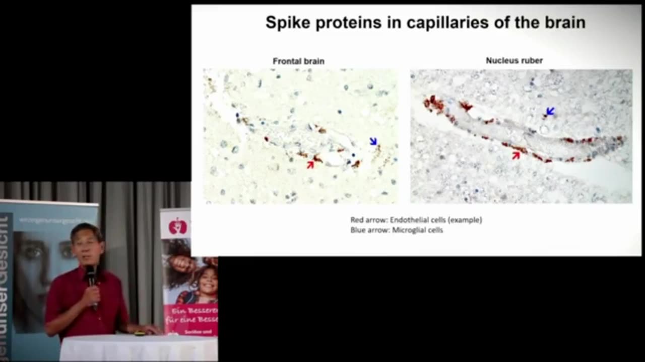 C19 Vaccines Causes Brain Damage & Personality Changes - Part #1
