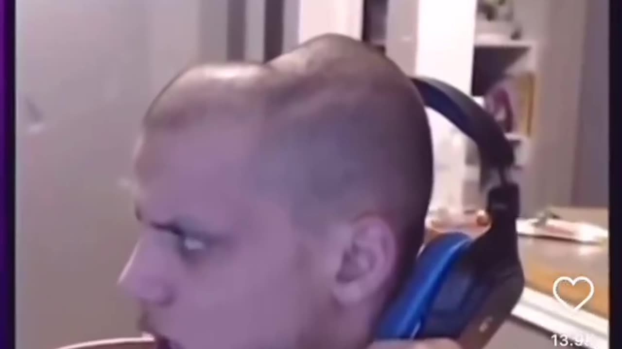 The Dent