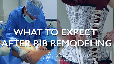 What to Expect After Rib Remodeling Surgery