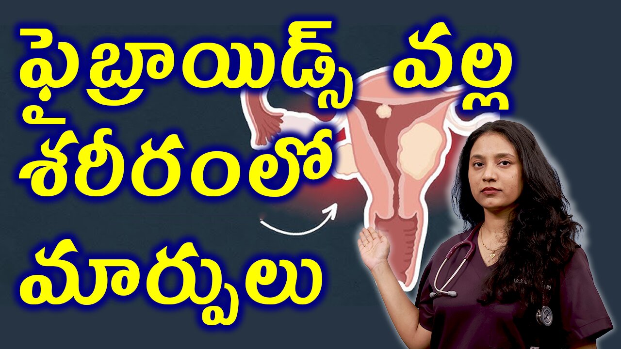 ఫైబ్రాయిడ్స్ వల్ల శరీరంలో మార్పులు Body changes in the Fibroids, leiomyomas or myomas | హోమియోపతి