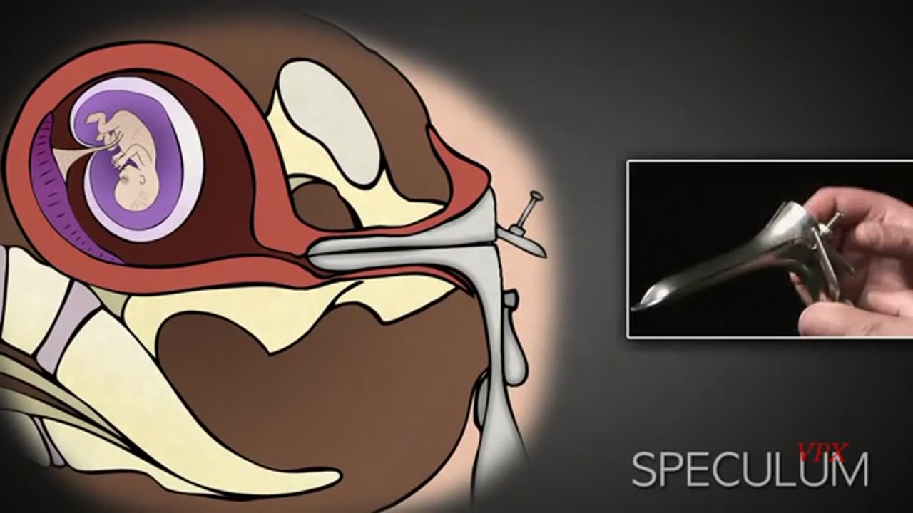 The Tactics of Abortion
