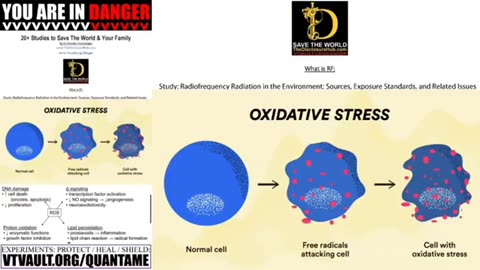 Dr. Robert Young ⚠️ Graphene is the shedding ⚠️ Sludge Blood clogging organs?