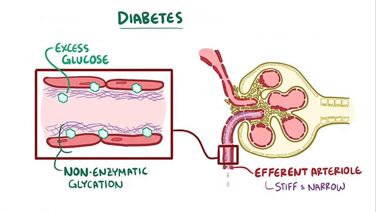 Chronic kidney disease - causes, symptoms, diagnosis, treatment, pathology