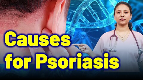 Important Causes for Psoriasis | Treatment Cure Relief Medicine | Skin Hair Nail | Homeopathy