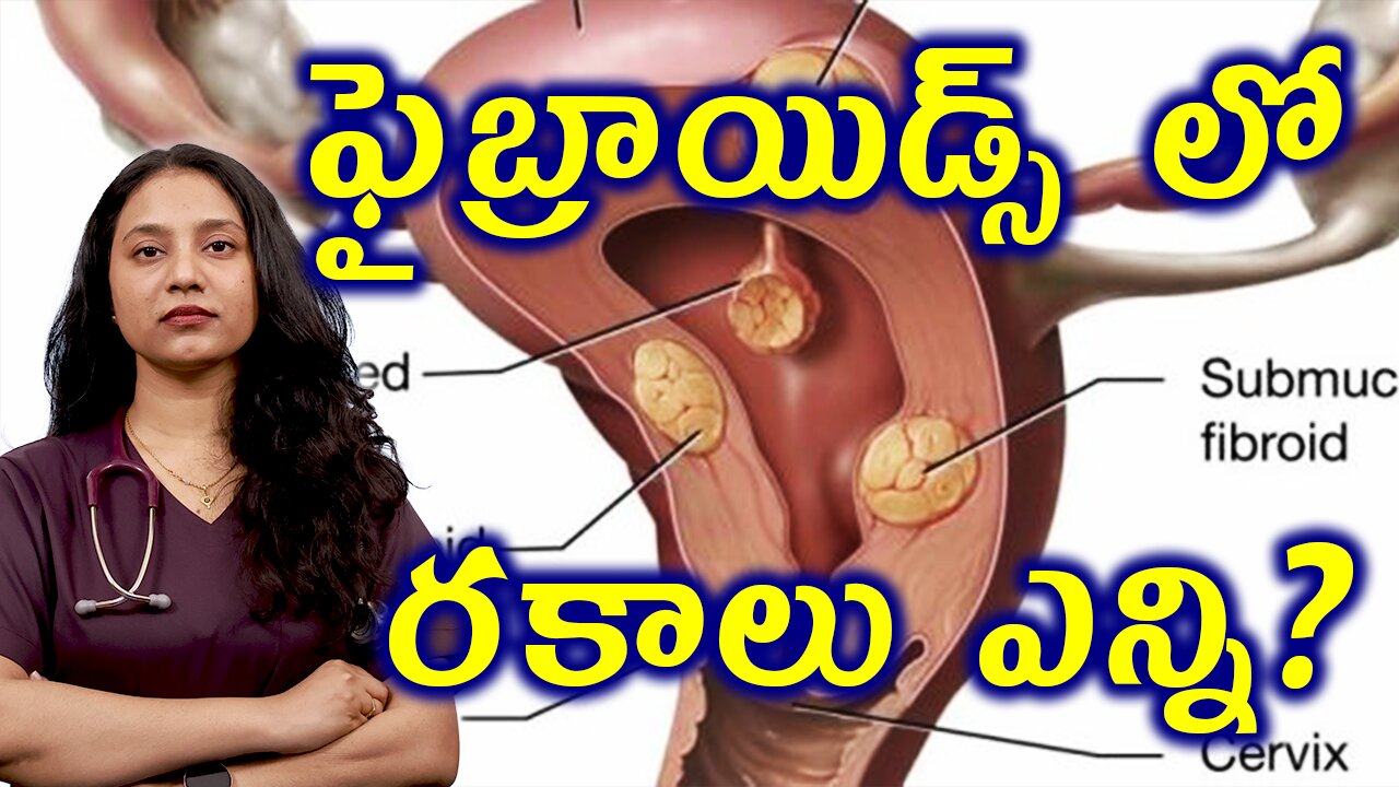 ఫైబ్రాయిడ్స్ లో రకాలు ఎన్ని? Types of Fibroids, leiomyomas or myomas | డా. భరద్వాజ్ | హోమియోపతి
