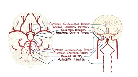 Ischemic Stroke - causes, symptoms, diagnosis, treatment, pathology