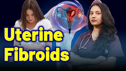 Effective Solution for Uterine Fibroids . | Treatment Cure Medicine | Gynaecology Women Female |