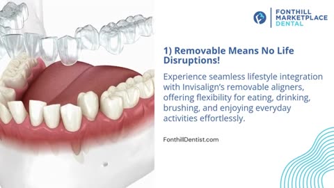 Why Invisalign May Be the Right Choice for Straightening Your Teeth?