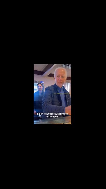 Joe Biden resurfaces with bruises on his Face & around his left Eye ...