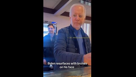 Joe Biden resurfaces with bruises on his Face & around his left Eye ...