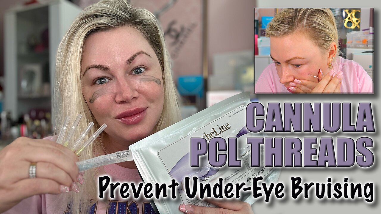 Cannula PCL Threads to Prevent Under Eye Bruising, AceCosm.com and Code Jessica10 Saves you money