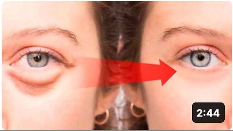 How to Get Rid of Puffy Eyes, Swollen Eyelids & Dark Circles