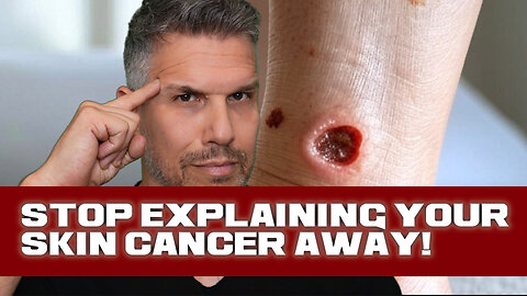 Stop Explaining Your Skin Cancer Away!