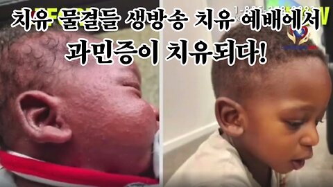 과민증이 치유되다! [크리스 목사님과 함께하는 치유 물결들 생방송 치유 예배 간증]
