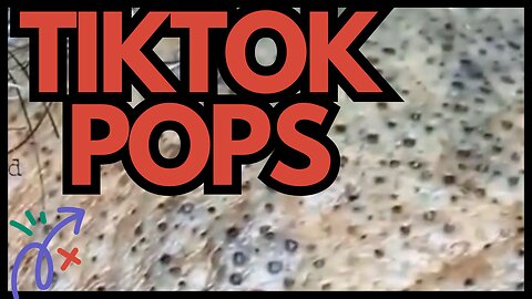 The BEST TikTok PIMPLES!