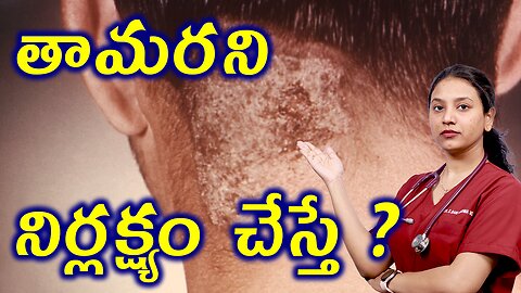 తామరని నిర్లక్ష్యం చేస్తే? What Happens if you Neglect Tinea or Ringworm? Homeopathy | హోమియోపతి