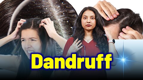 Get Rid of Dandruff, Scalp Flaking,Pityriasis Permanently .| Treatment & Cure| Homeopathy, Medicine