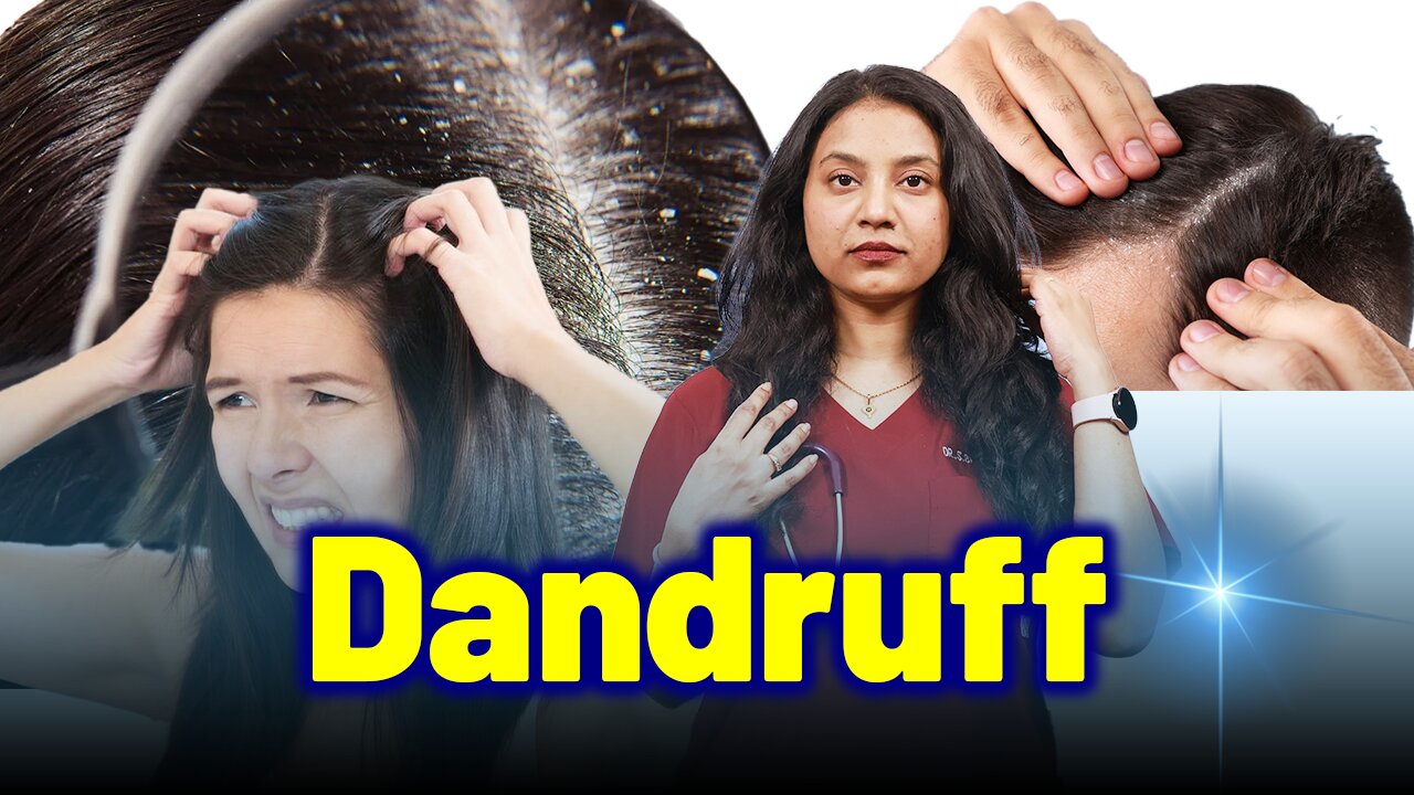 Get Rid of Dandruff, Scalp Flaking,Pityriasis Permanently .| Treatment & Cure| Homeopathy, Medicine