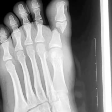 Dr. Fredy Portillo: No todo requiere una cirugia