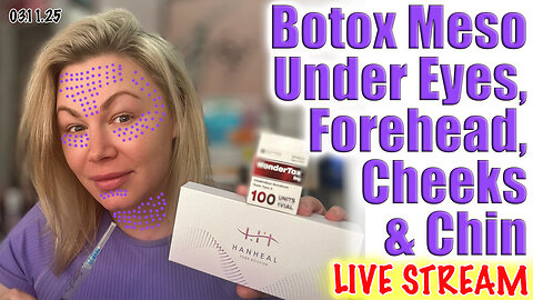 Live Botox Meso Under Eyes, Forehead, Cheeks & Chin! AceCosm.com | Code Jessica10 Saves You Money