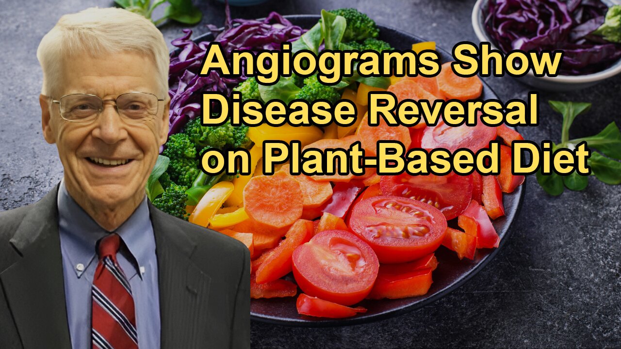 Angiograms Showing Disease Reversal in Patients Following a Plant-Based Diet