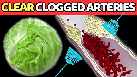 Top 7 Best Vegetables To Clean Arteries And Prevent Heart Attack