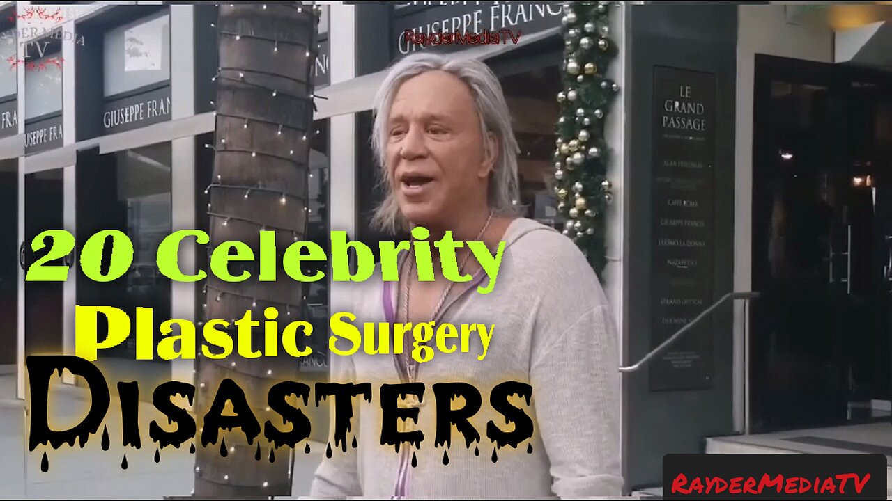 20 Celebrity Who Became Plastic Surgery Disaster | RayderMediaTV