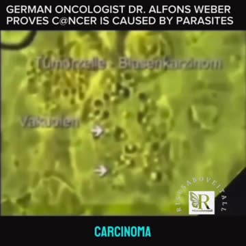 Parasites proven years ago by this German Dr Alfons