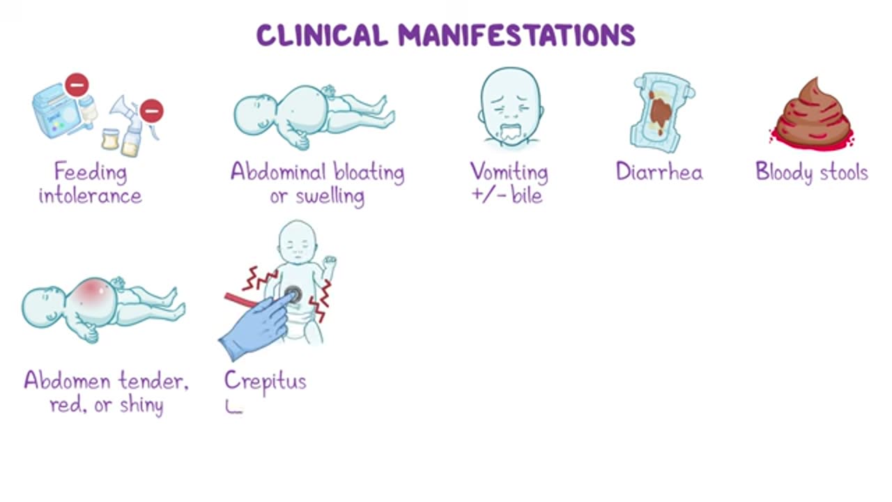 Clinical manifestations