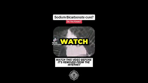 Sodium Bicarbonate as a medication