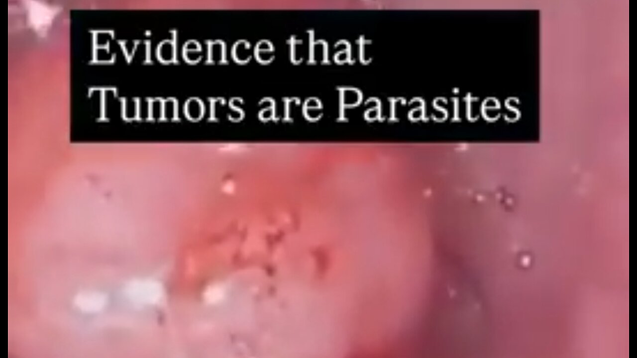 HEY, YOU WON’T BELIEVE WHAT’S HIDING OUT IN THIS TUMOR: IT TURNS OUT TUMORS CAN HOLD PARASITES! ☠️