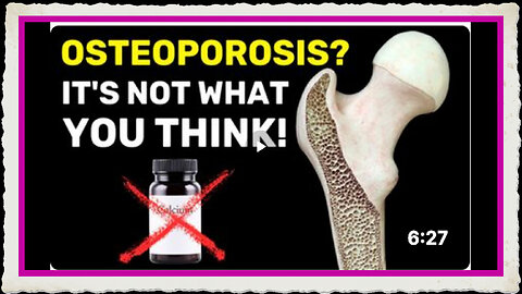 The Hidden Cause of Osteoporosis (It's Not Calcium Deficiency!)