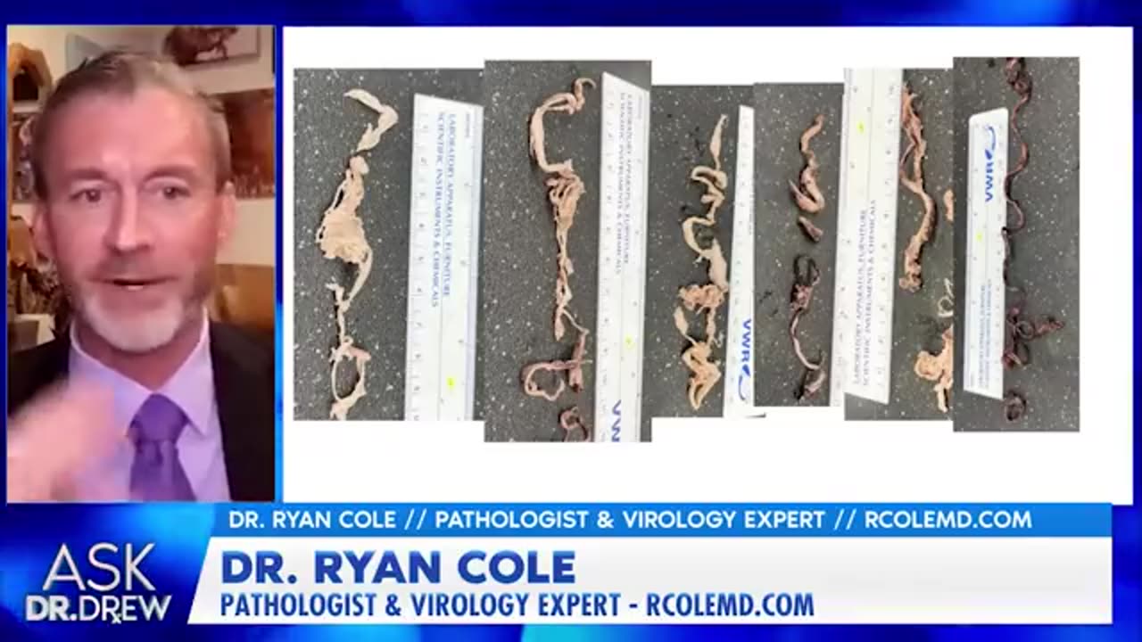 🔥💥Dr. Ryan Cole, talks about clots he’s finding in mRNA injected live/dead ppl & how to disolve them