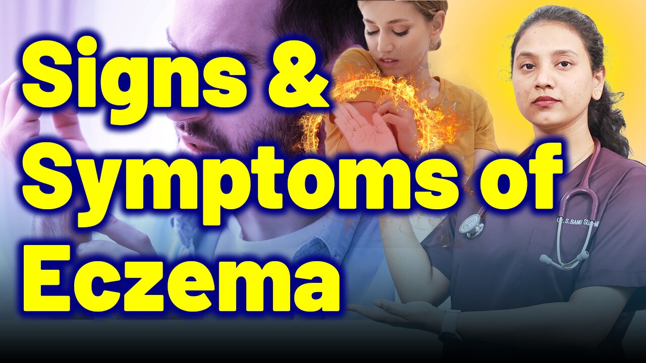 Signs & Symptoms of Eczema, Atopic Dermatitis. | Treatment & Cure | Homeopathy, Medicine & Surgery