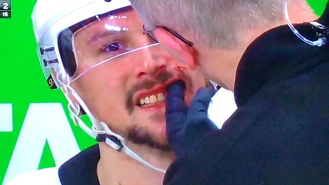 Penguins D #65 Erik Karlsson gets hit in the face with the puck. Ouch 🤕