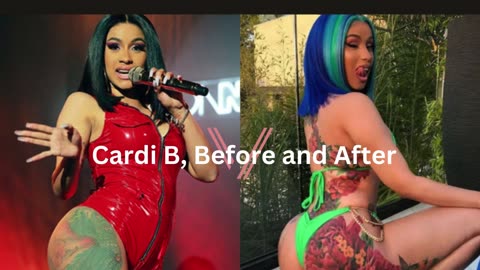 Cardi B Butt Implants, Brazilian Butt Lift, BBL, while glamorous at first, she now had it removed.