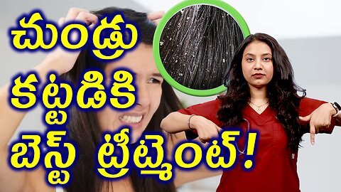 చుండ్రు కట్టడికి బెస్ట్ ట్రీట్మెంట్ Advantages of Homeopathy in Treating Dandruff Control హోమియోపతి
