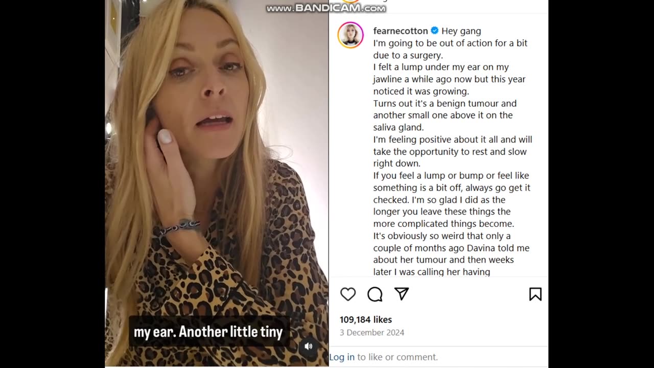 Celebrity Fearne Cotton reveals she has had surgery to remove two tumours on her jawline - 2024