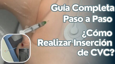 Guía Paso a Paso para la Inserción de un Catéter Venoso Central | Técnica y Seguridad