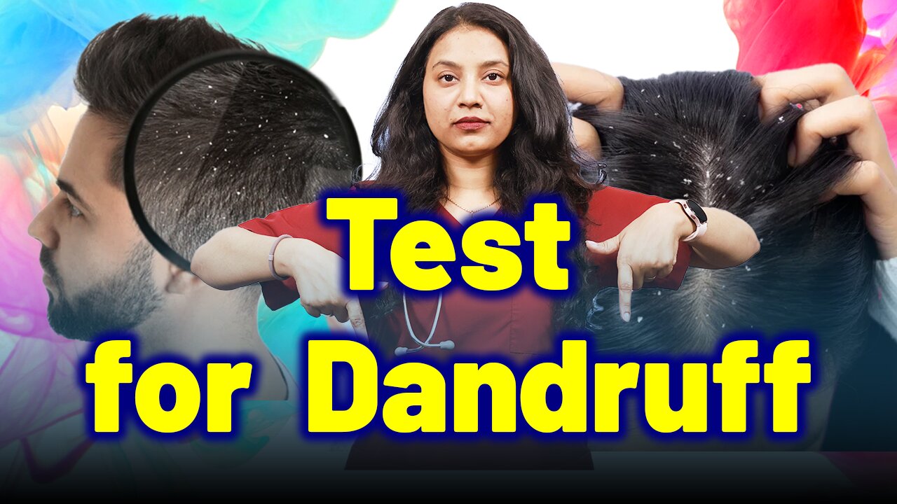 Test for Dandruff, Seborrheic Dermatitis, Psoriasis | Treatment & Cure | Homeopathy, Medicine