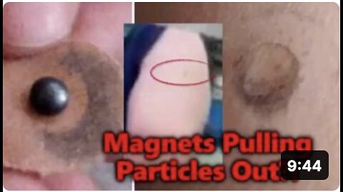 Mysterious : Magnets Pull Particles Through People's Skin?