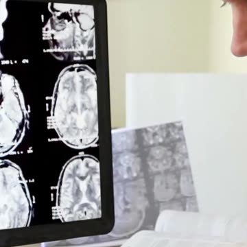 Google's Mind-Blowing AI Is Already Curing Diseases! (See the Proof!) News
