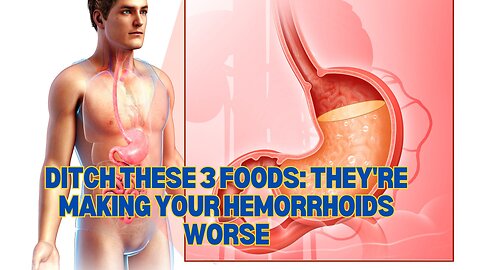 3 Foods to Avoid for Hemorrhoid Relief: What, Why, and Solutions