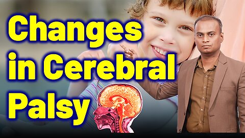 Body Changes in Cerebral Palsy .| Dr. Bharadwaz | Medicine & Treatment Cure