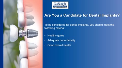 How Dental Implants have revolutionised Dentistry!